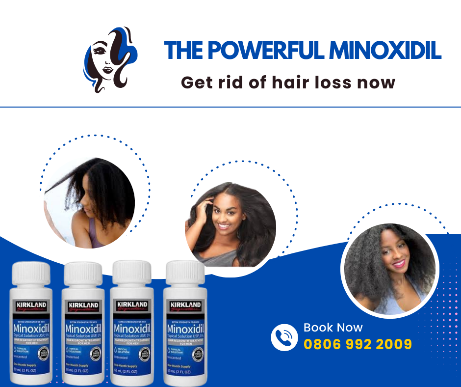 MINOXIDIL WORKS